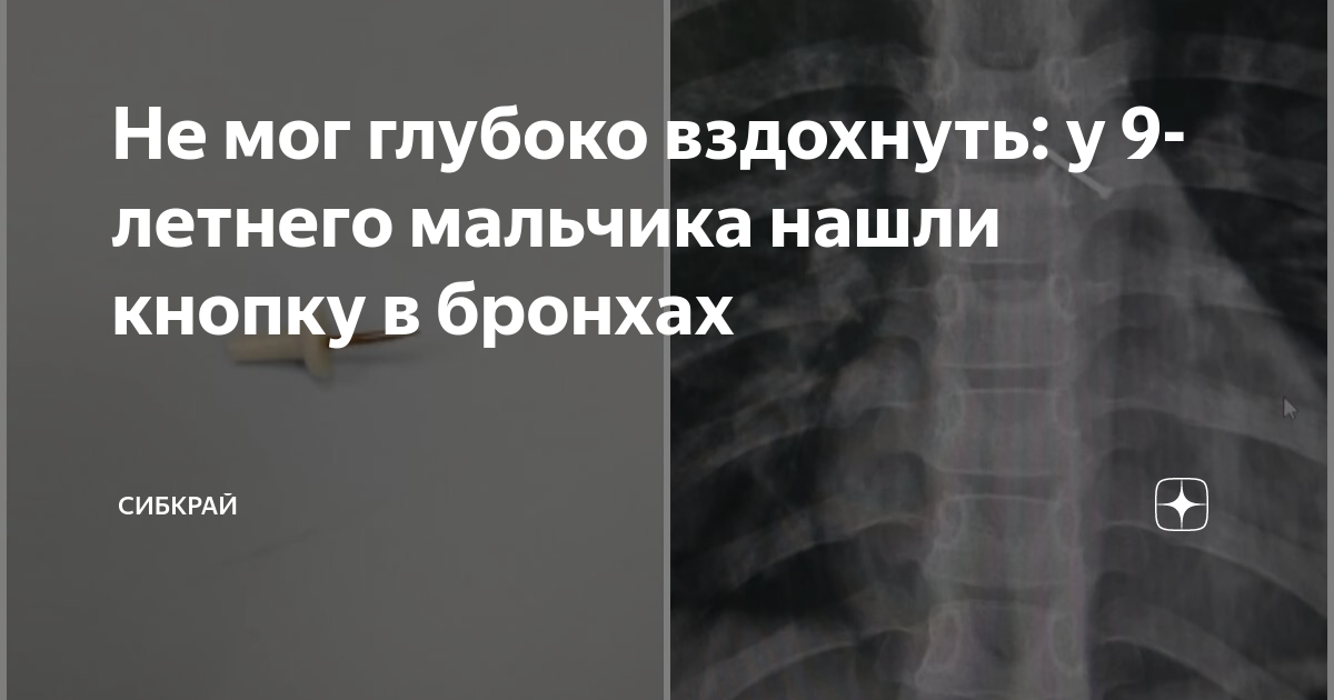 Что может быть глубоким. Что может быть глубоким