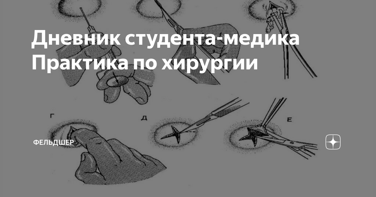 Дневник студента-медика Практика по хирургии | Фельдшер | Дзен