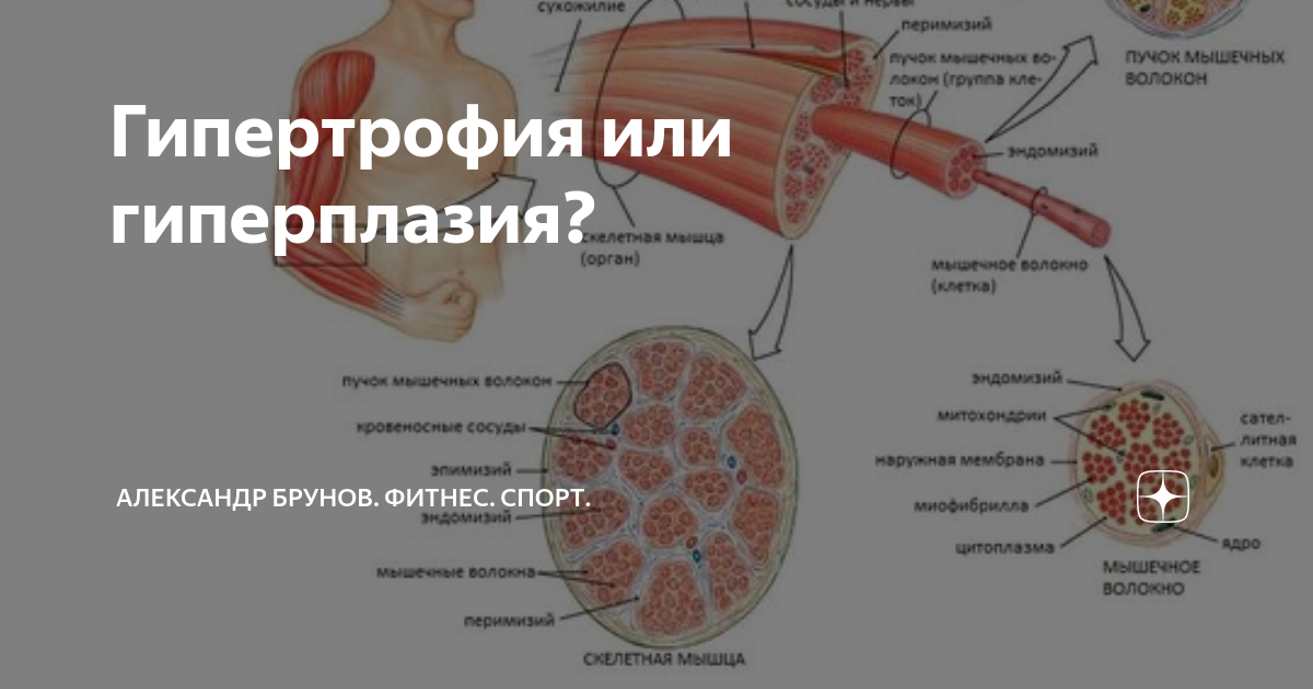 Что такое гиперплазия мышц?