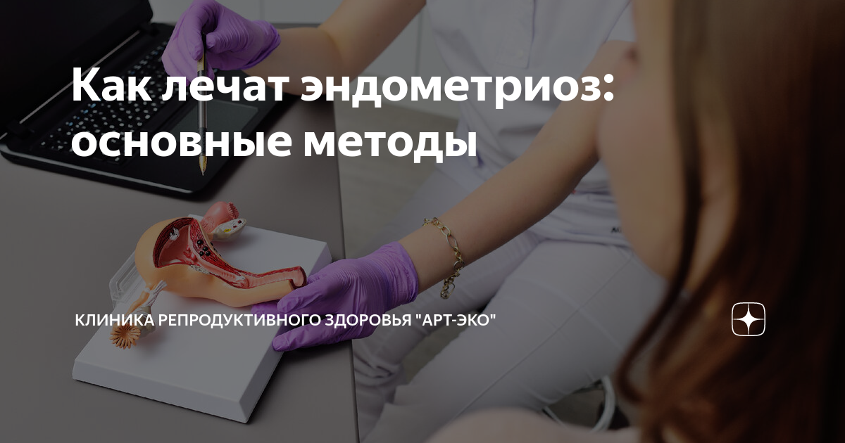 Как лечат эндометриоз: основные методы | Клиника репродуктивного ...
