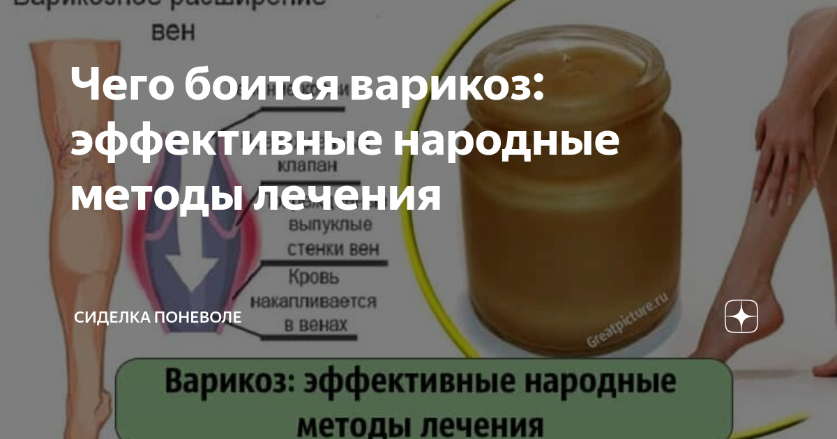 Народные средства лечения варикозного расширения. Синтетические препараты для лечения варикозной болезни. Лучшие народные средства от варикоза. Оперативное лечение варикозного расширения вен.