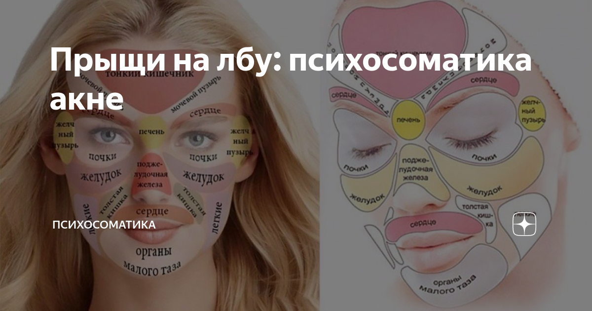 Психосоматика прыщей на лице. Прыщи на лбу психосоматика. Прыщи психосоматика. Психосоматика прыщи на лице у девушки. Прыщи на теле психосоматика