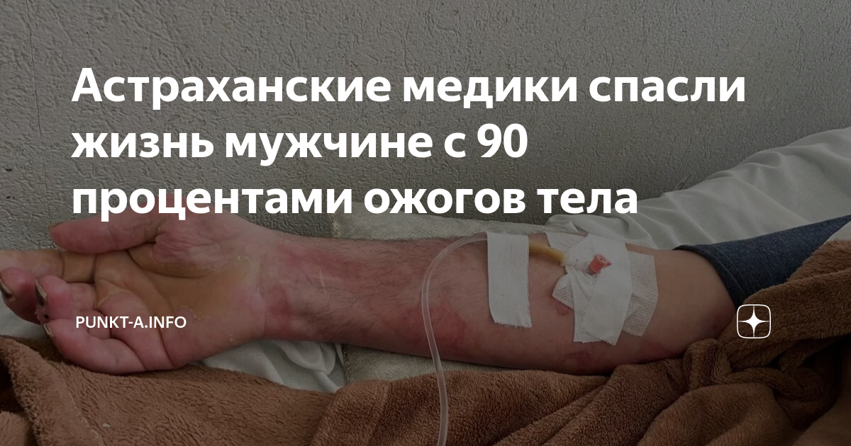 Девочку из Октябрьского, которая получила 90% ожогов тела, на вертолёте санавиации доставят в Пермь