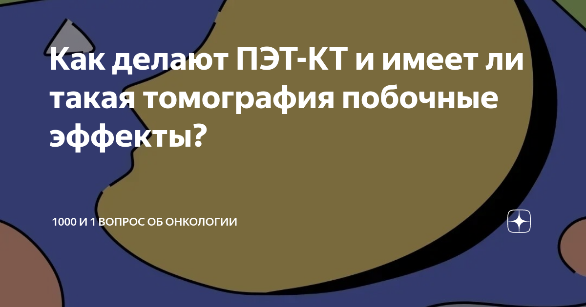 Как делают ПЭТ-КТ и имеет ли такая томография побочные эффекты? | 1000 ...