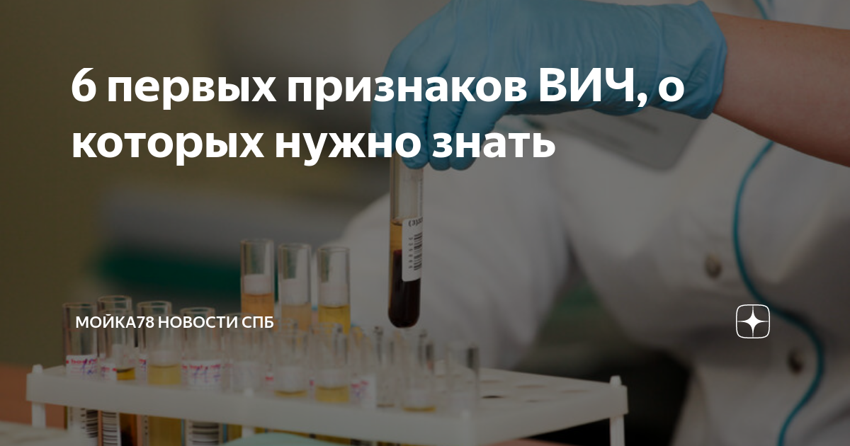 6 первых признаков ВИЧ, о которых нужно знать | МОЙКА78 Новости СПб | Дзен