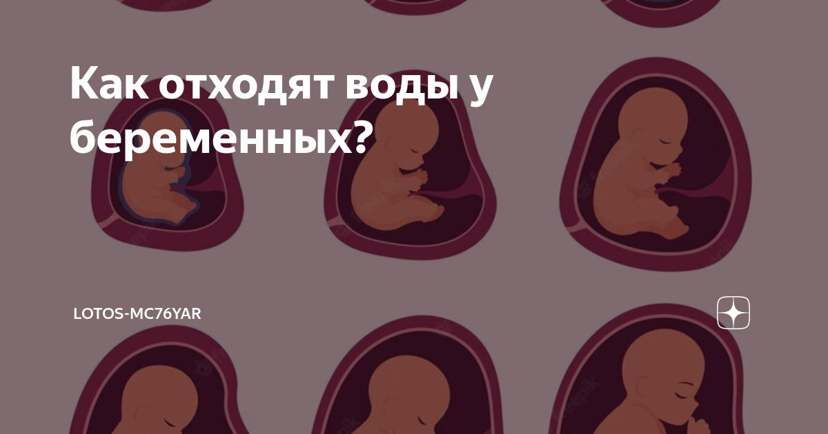 Пиотыкание окоплодныхвод. Питьевой режим беременной женщины. Забеременела через воду. Забеременела через воду. Забеременела через воду.