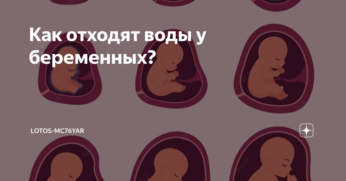 Выжидательная тактика в родах — зачем нужно ждать?