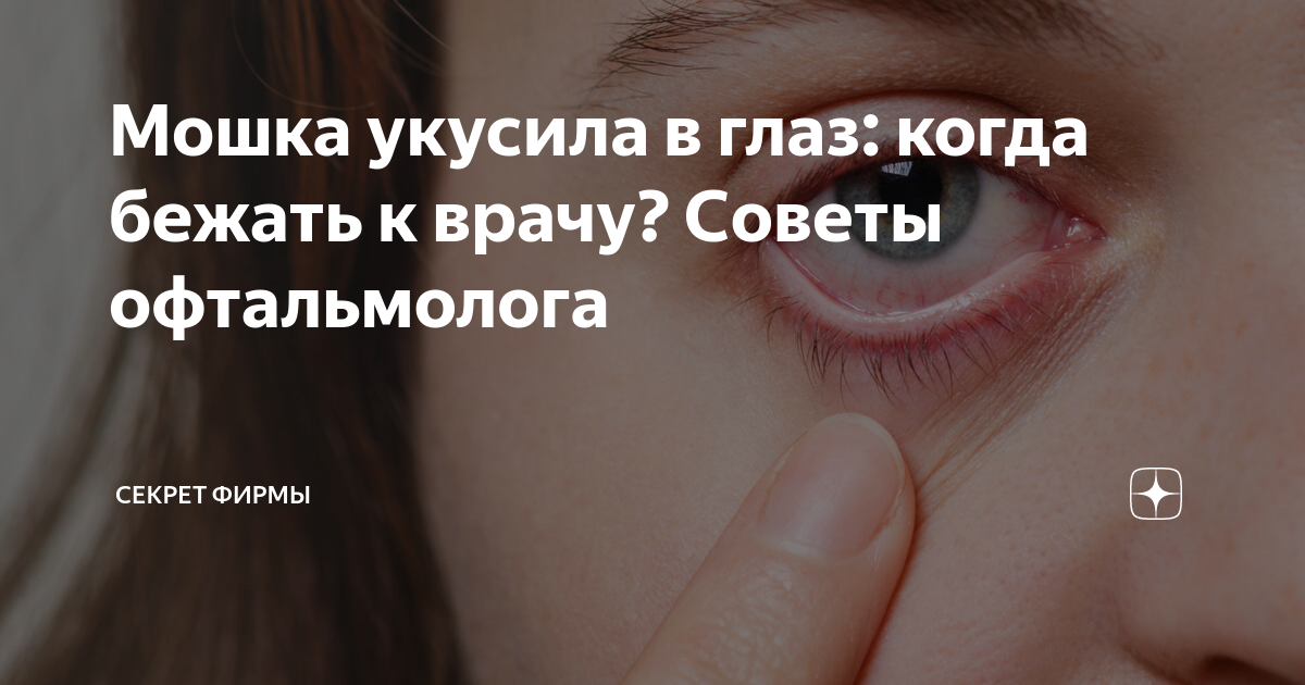 Что делать, если ребенка укусила мошка, комар или пчела? | Правмир