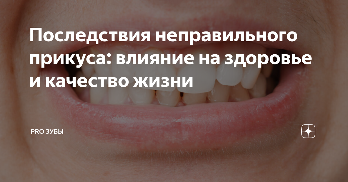 Вклад прикуса в проблемы с пищеварением
