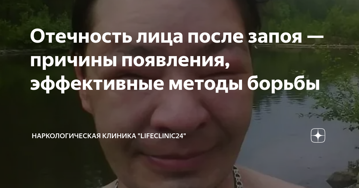 отечность лица с утра причины
