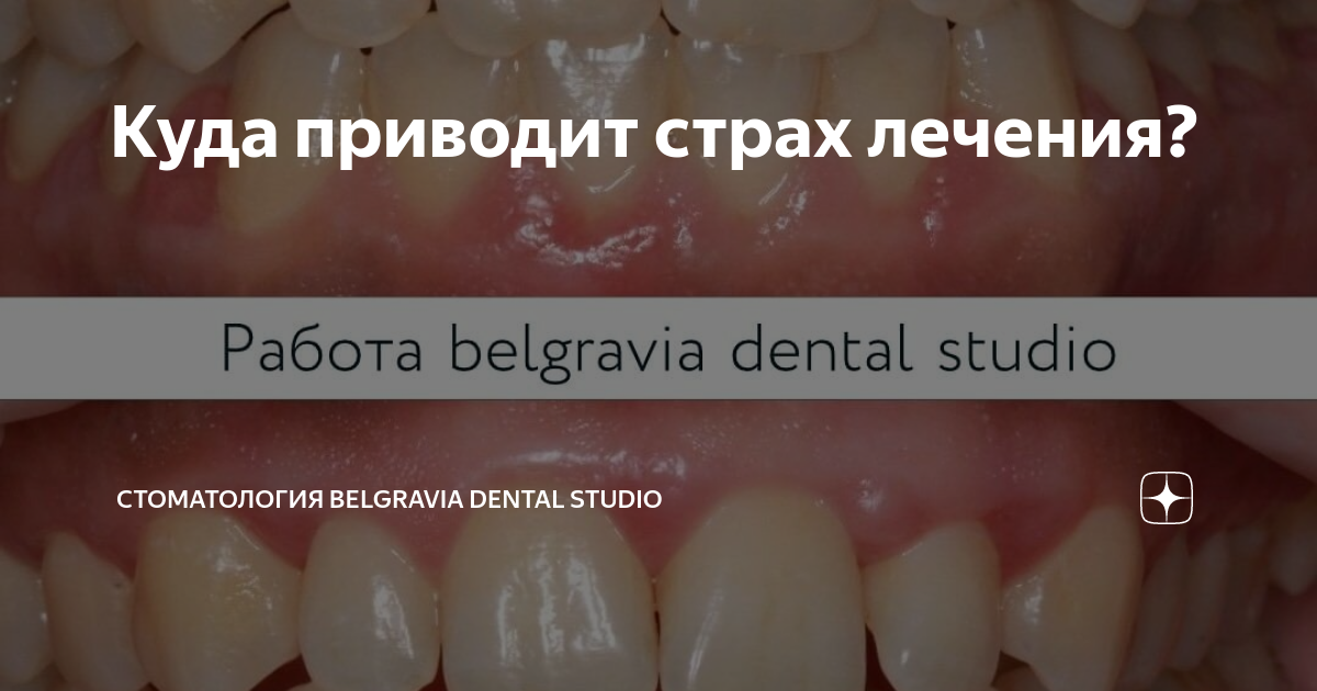 Куда приводит страх лечения? | Стоматология Belgravia Dental Studio | Дзен
