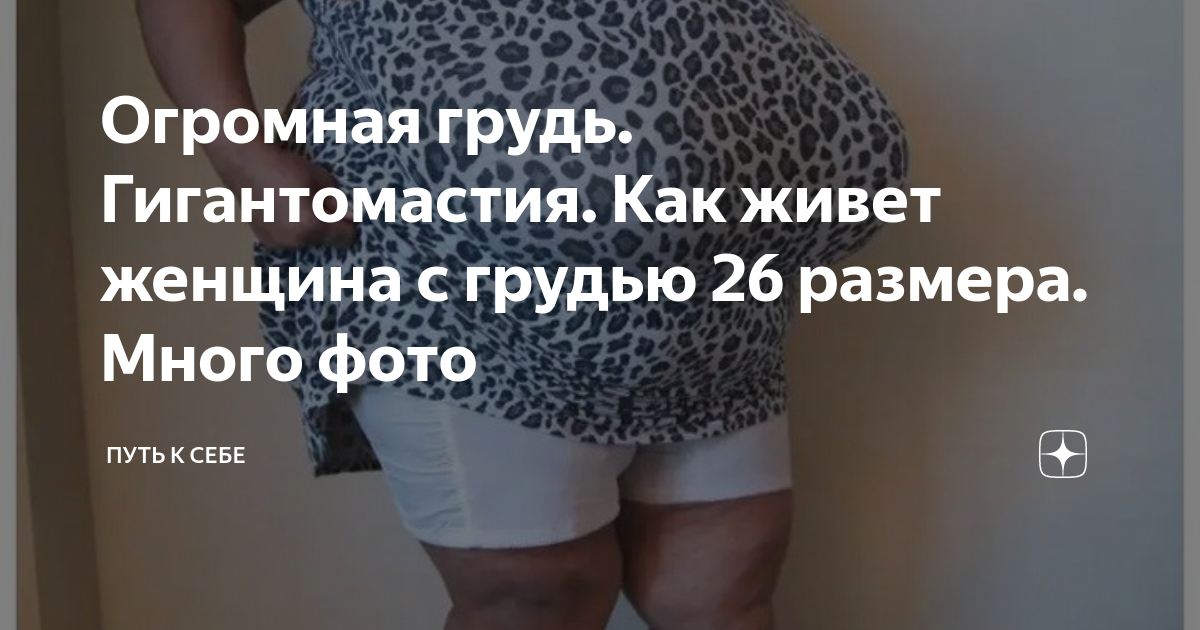 огромные груди Огромная грудь. Гигантомастия. Как живет женщина с грудью 26 размера. Много  фото | Путь к себе | Дзен