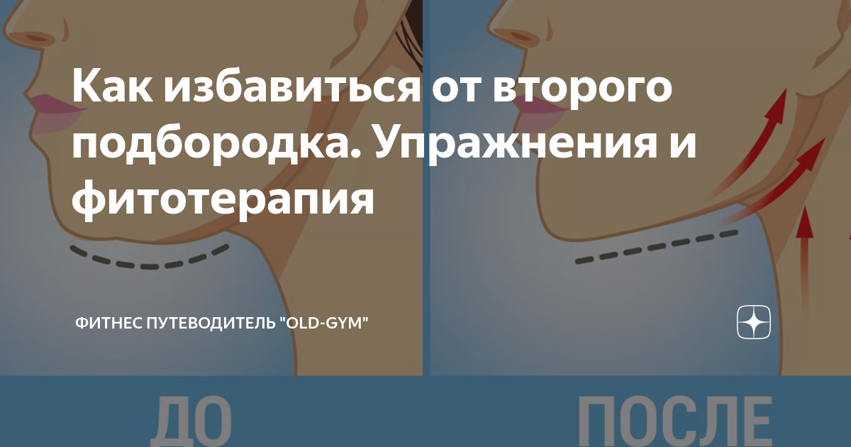 возможно ли убрать второй подбородок упражнениями