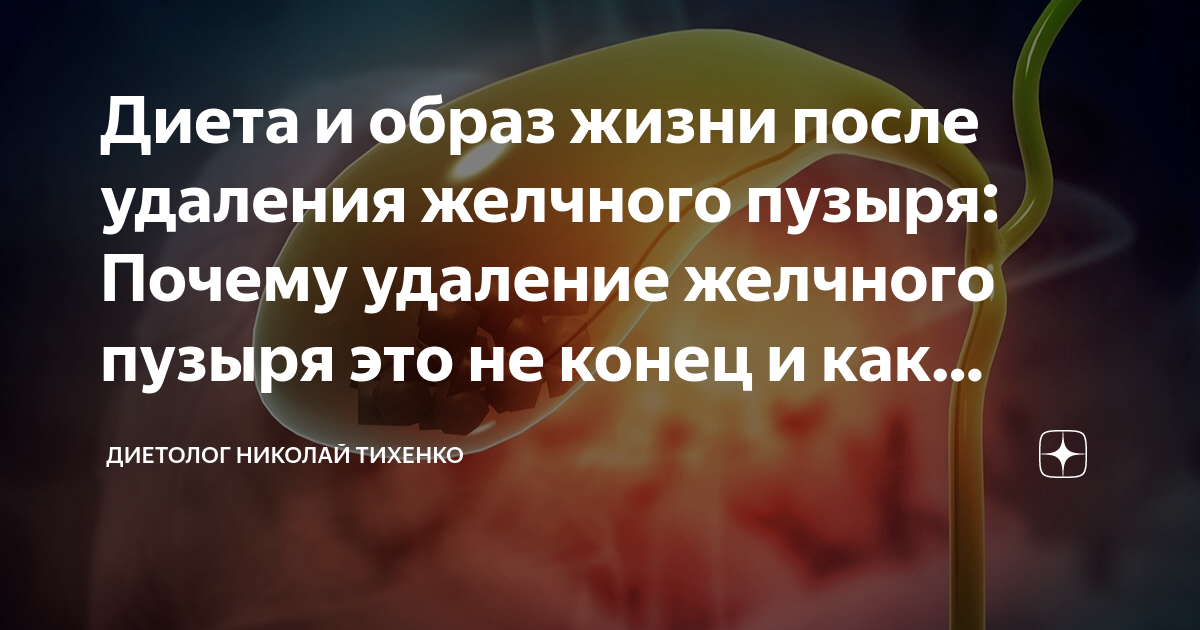 Желчегонные продукты: что нужно есть при холецистите