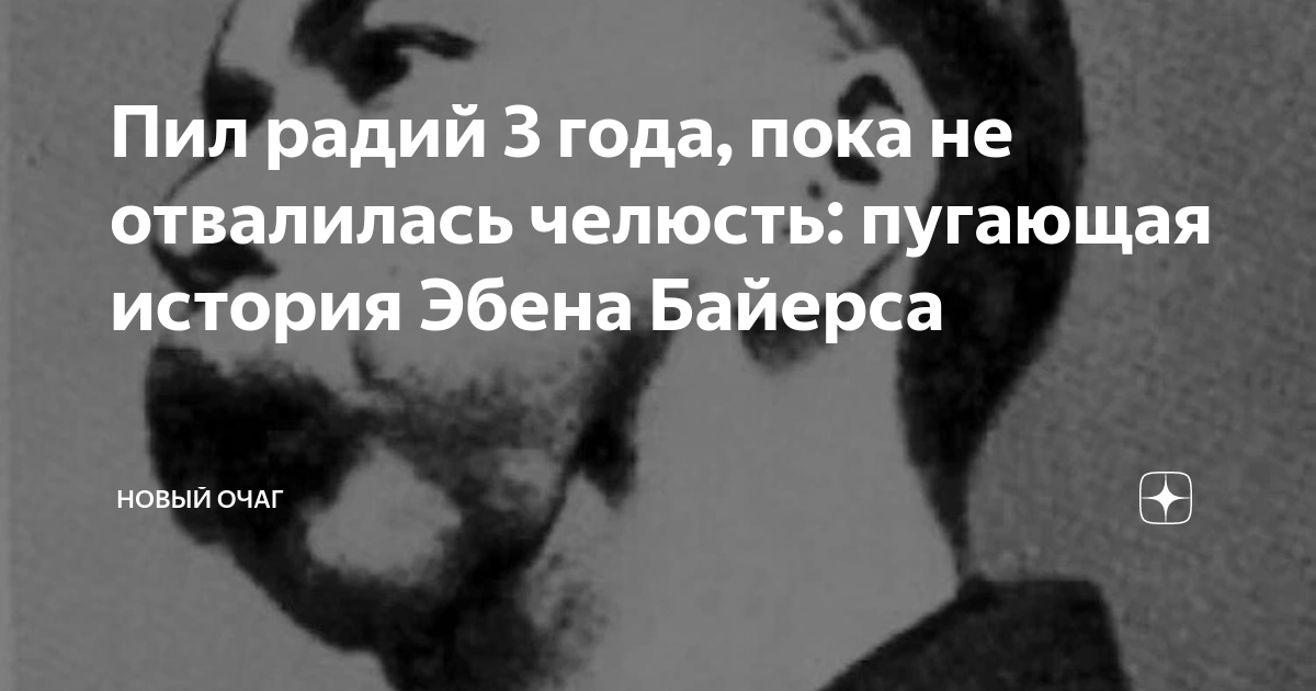 Пил радий 3 года, пока не отвалилась челюсть: пугающая история Эбена ...