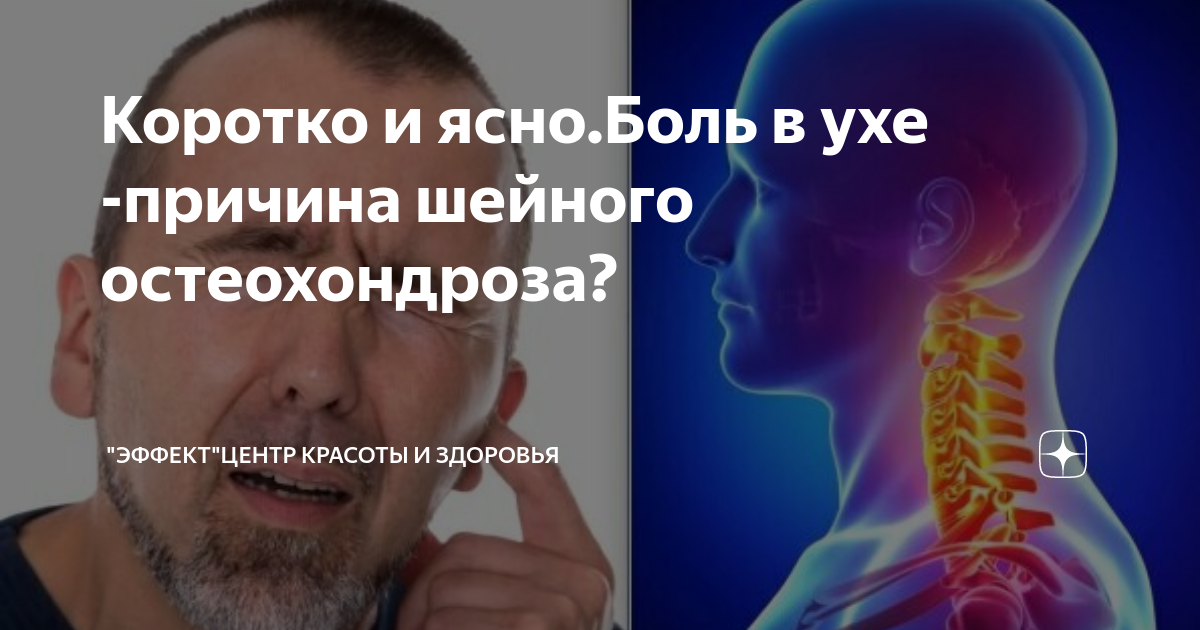 Найз помогает шеи. Может ли при остеохондрозе закладывать уши. Может ли при остеохондрозе закладывать уши. При наклоне головы вниз. Шейный остеохондроз симптомы.