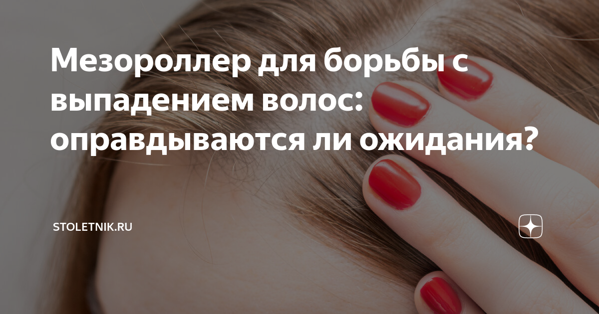 Мезороллер для борьбы с выпадением волос: оправдываются ли ожидания ...