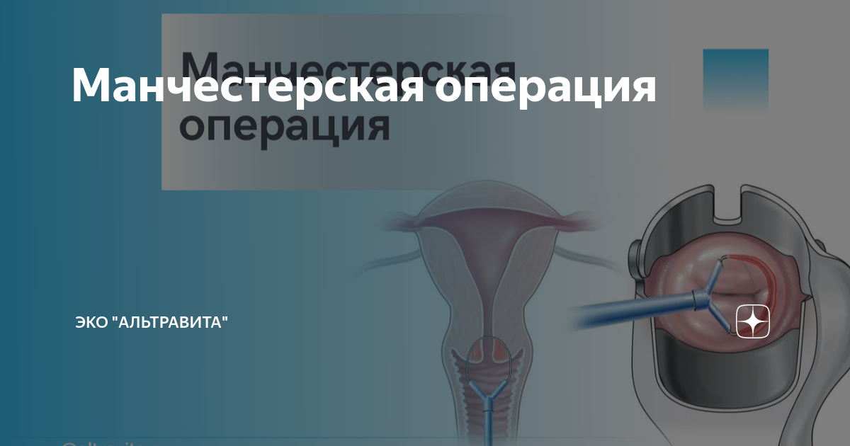 операция мастоидита
