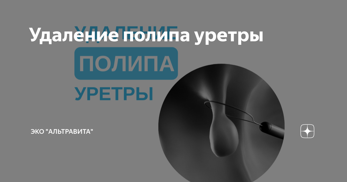 Лечение уретероцеле в Хабаровске - Медикъ