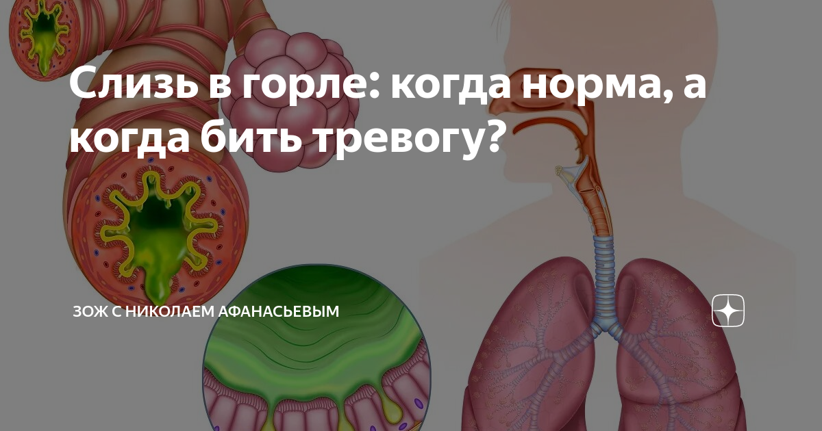 Картинки СЛИЗЬ В ГОРТАНИ КАК ИЗБАВИТЬСЯ