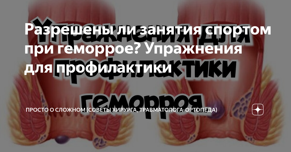 Разрешены ли занятия спортом при геморрое? Упражнения для профилактики ...