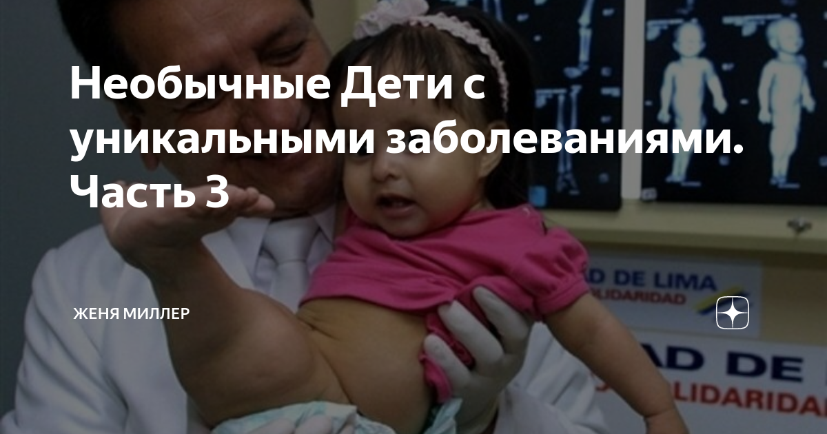 Необычные Дети с уникальными заболеваниями. Часть 3 | Женя Миллер | Дзен