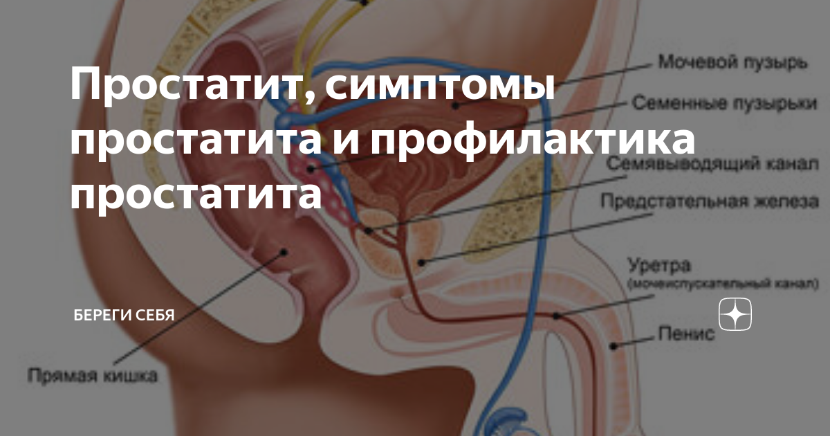 Крем Здоров от простатита - правда или развод?