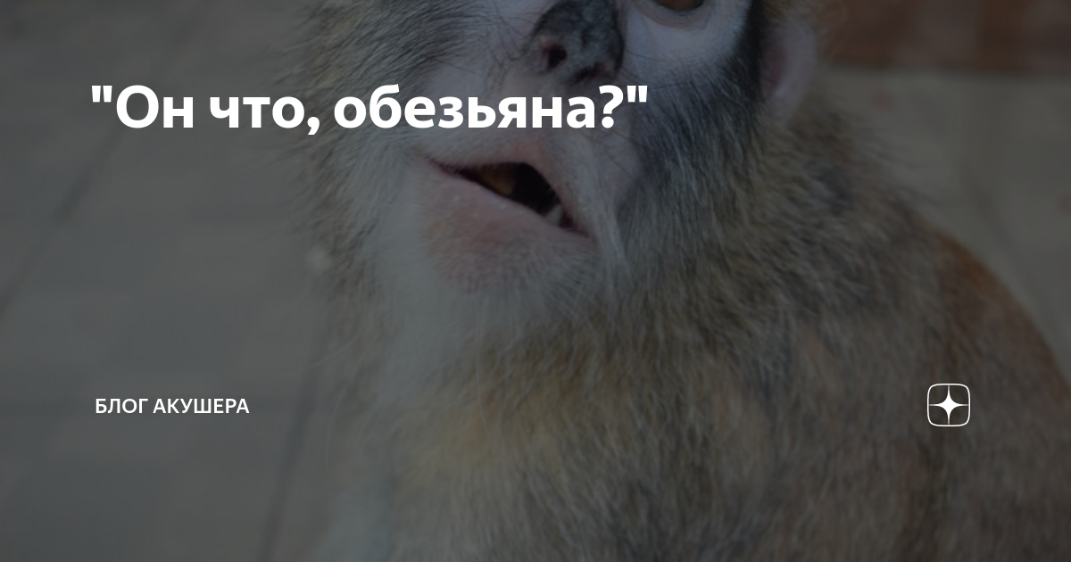 "Он что, обезьяна?" | Блог акушера | Дзен