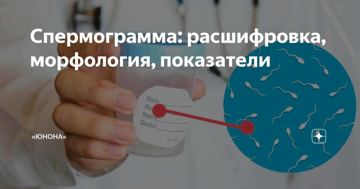 Показатели спермограммы: где можно сдать и как это сделать правильно