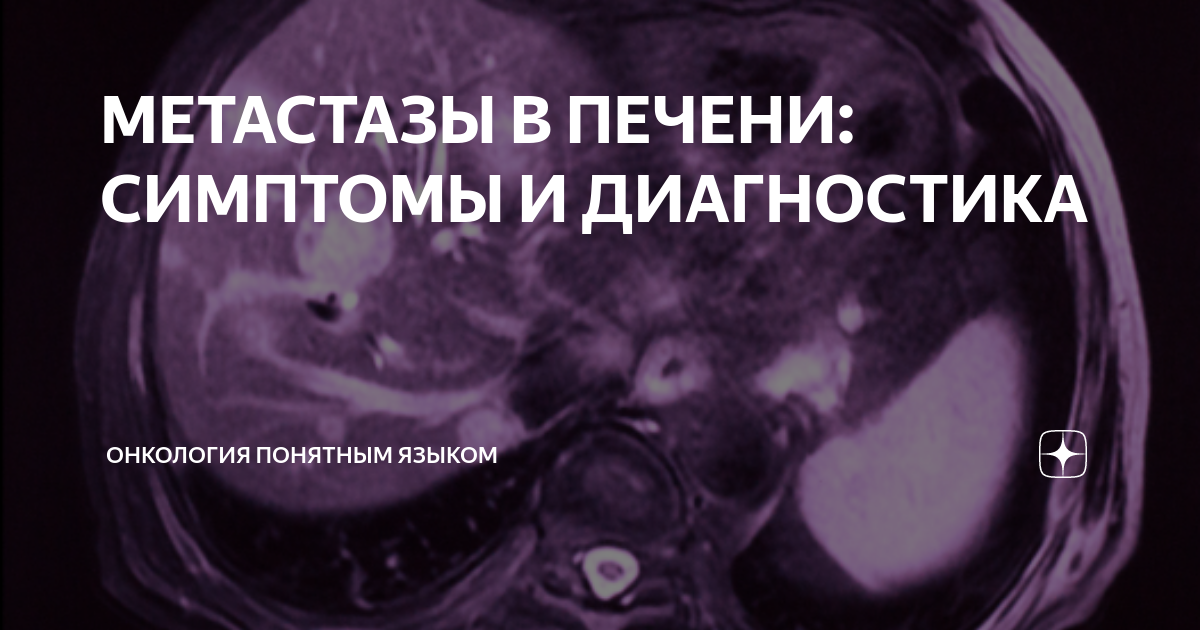 метастазы в печени сколько осталось жить