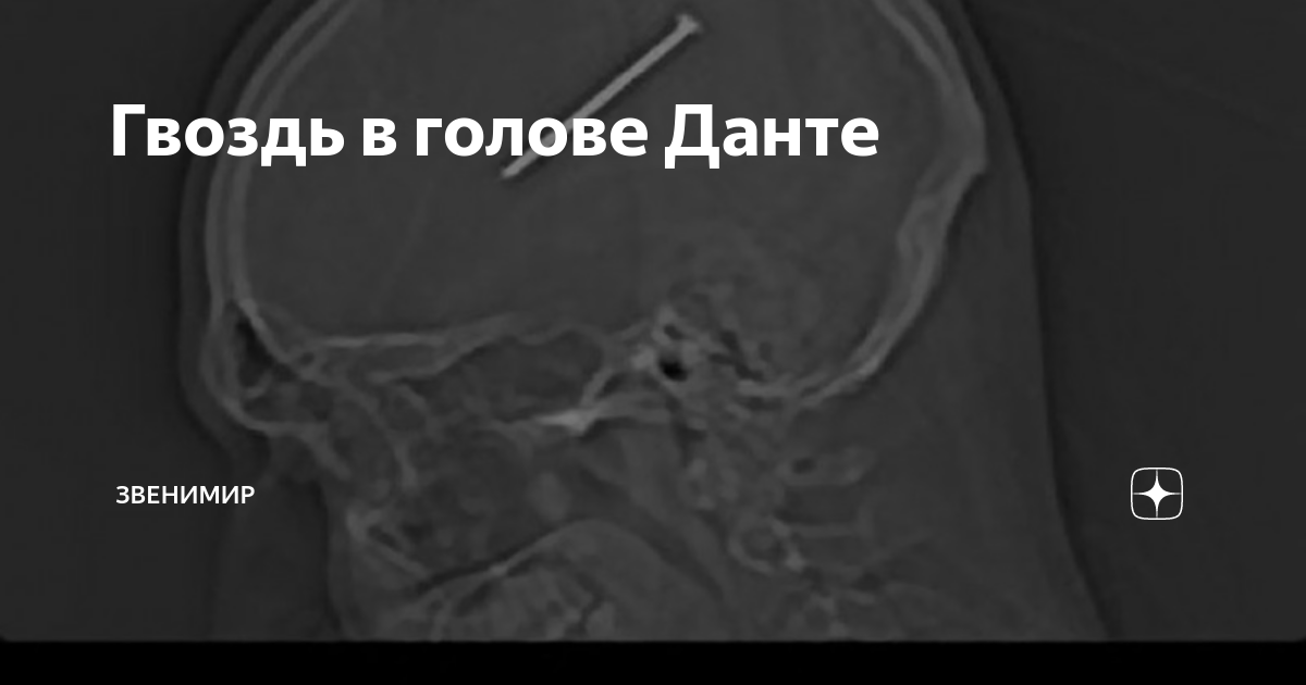 Гвоздь в голове Данте | Звенимир | Дзен