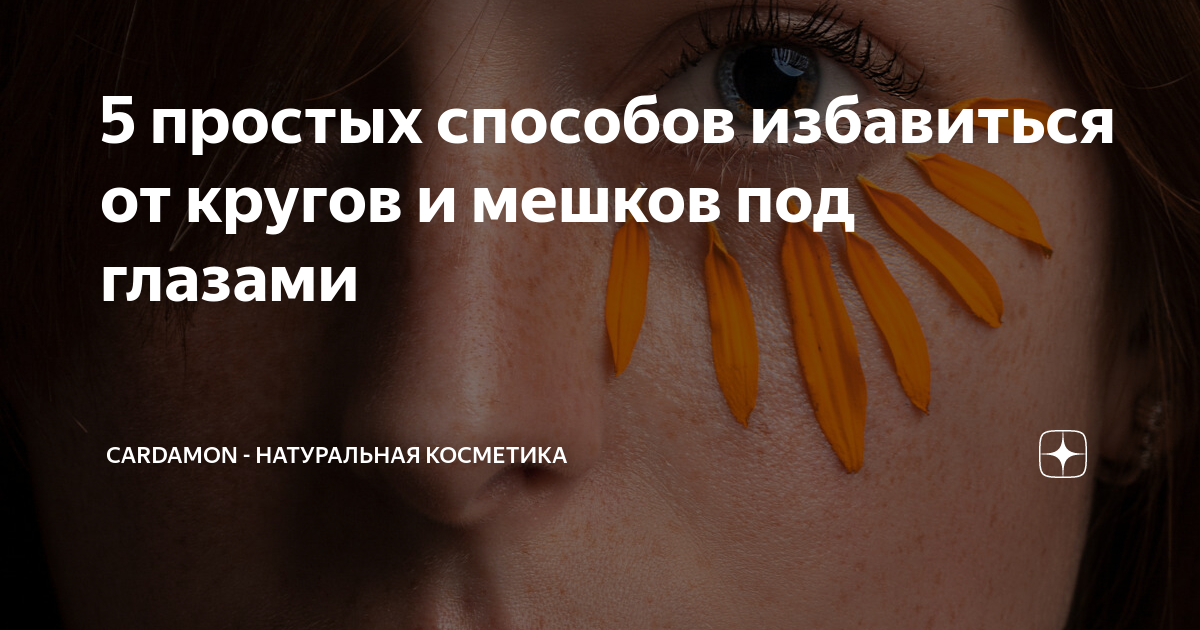 как избавится от черных кругов под глазами в домашних условиях