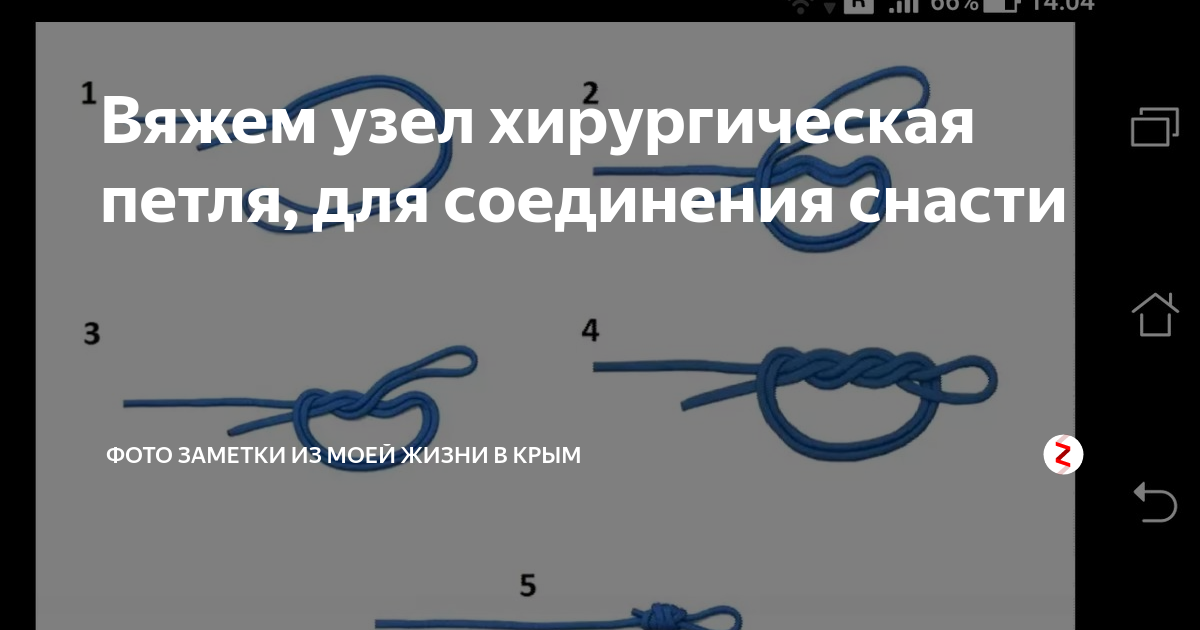 Как завязать простой хирургический узел: виды и способы образования, классически