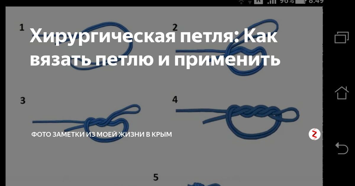Петли в отношениях. Узел хирургическая петля. Хирургическая петля для рыбалки. Рыболовные узлы хирургическая петля. Узел для соединения петля в петлю