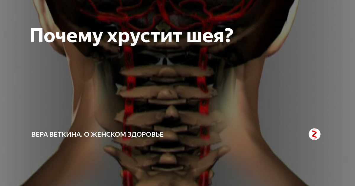 Почему слышен хруст. Шейный остеохондроз хруст в шее. Хруст в шее при поворотах головы. Хрустит шейный отдел позвоночника