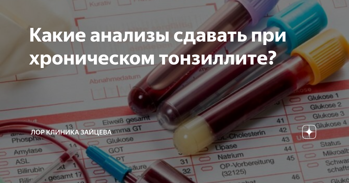 Тонзиллит какие анализы сдать. Сдать анализы. Анализы при хроническом тонзиллите. Тонзиллит какие анализы нужно сдать. Какой анализ сдают при тонзиллите.