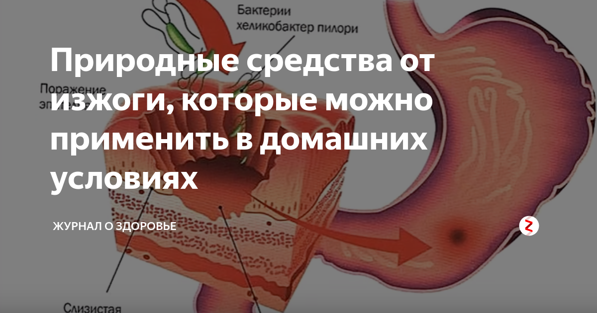 Изжога причины способы устранения у мужчин. Устранение изжоги. Изжога после еды. Почему изжога после еды.