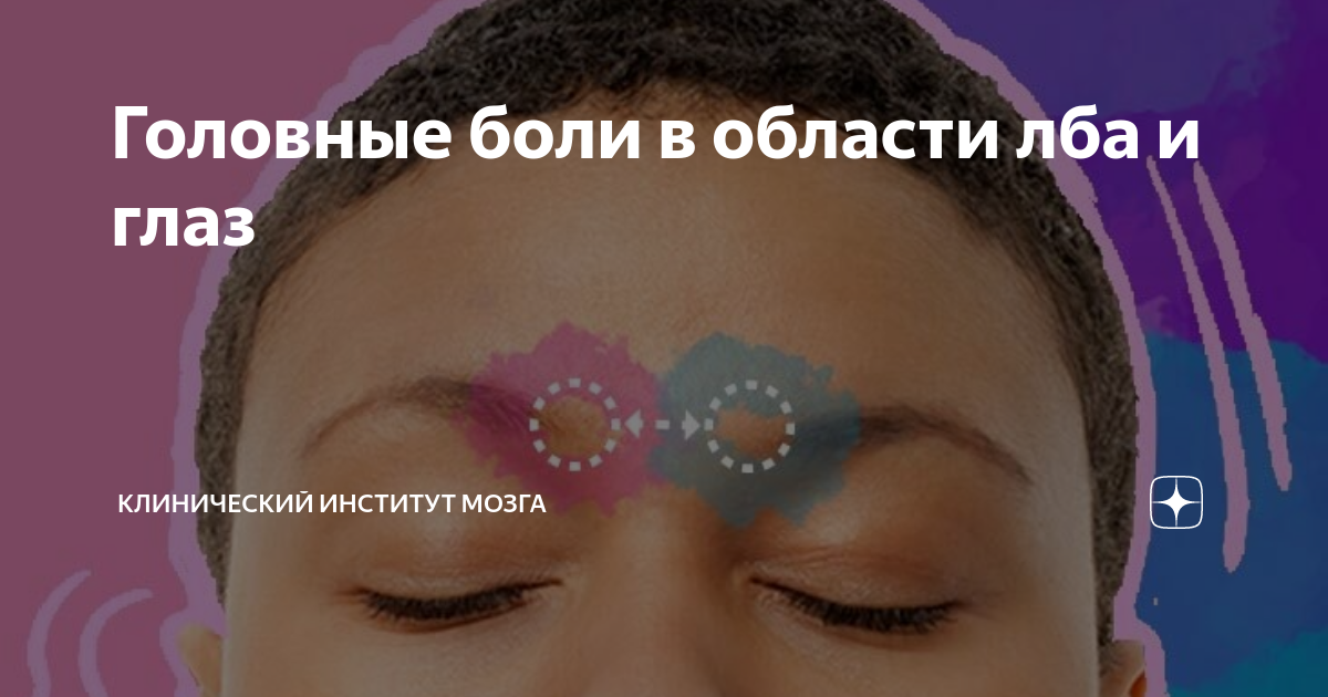 Головные боли в области лба и глаз | Клинический Институт Мозга | Дзен