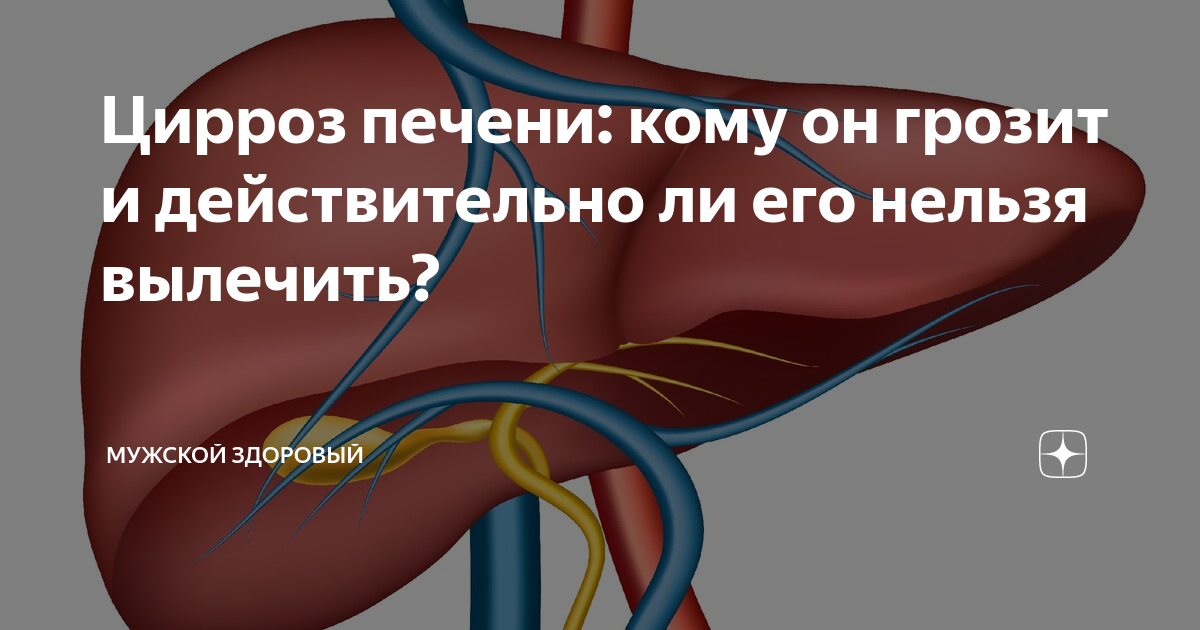 Гастроэнтеролог печень. Цирроз печени хирургия. Цирроз терапия или хирургия. Покойник с циррозом печени. Здоровые яйца от цирроза печени