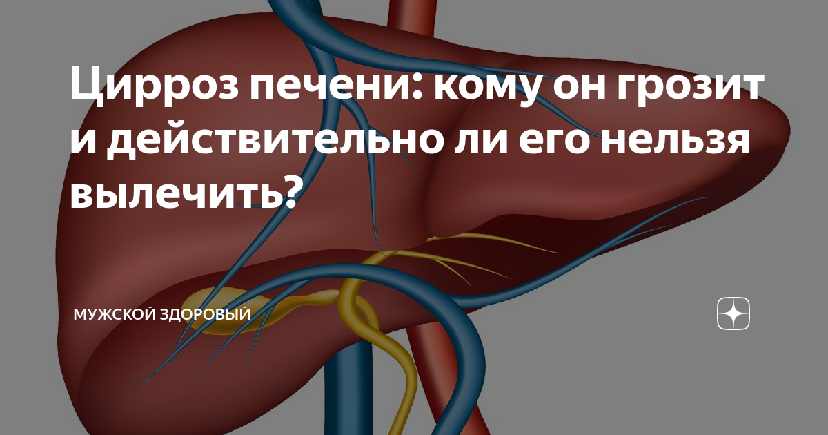 Цирроз печени давление низкое. Цирроз печени хирургия. Цирроз терапия или хирургия. Покойник с циррозом печени. Здоровые яйца от цирроза печени.