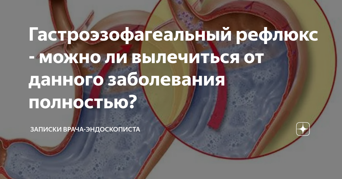 День эндоскописта 23 мая. День эндоскописта в России. С днем эндоскописта картинки. День эндоскописта открытки.