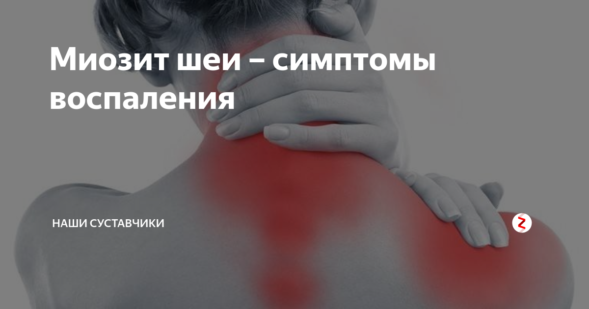 Шейный миозит карта вызова