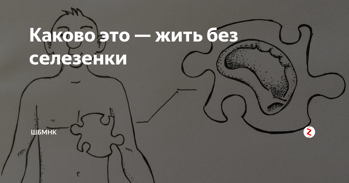 Как жить без селезенки. Может ли человек жить без селезенки. Жизнь без селезенки в организме человека. Человек без селезенки долго живет?. Человек может без селезенки прожить.