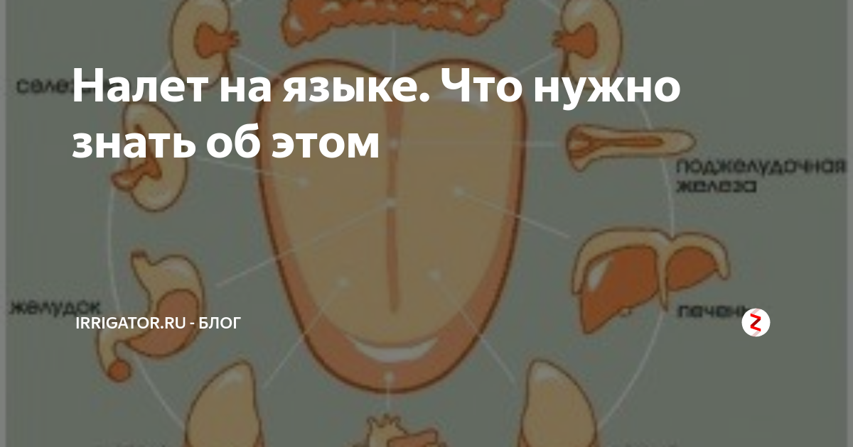 Желтый налет на языке