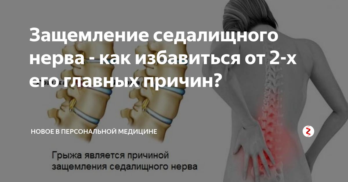 Защемление нерва фото Защемление нерва фото