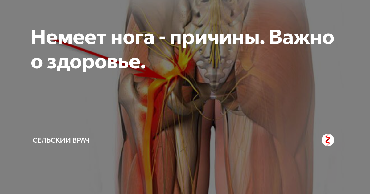 Почему немеют ноги. Болит и немеет левая нога