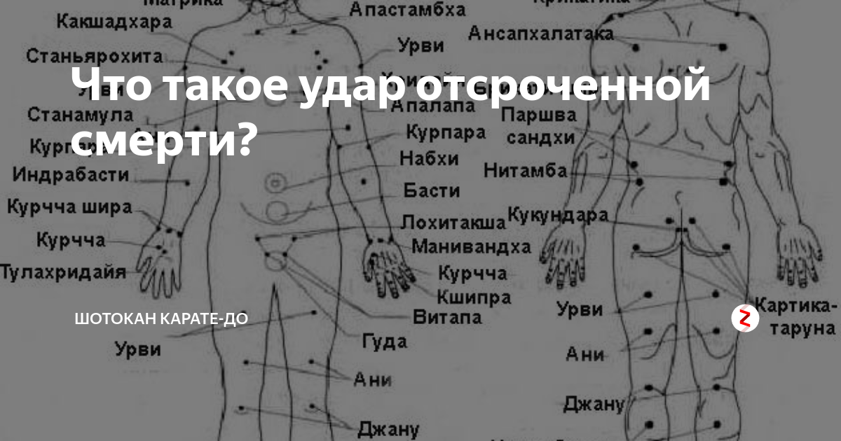 Точка q у женщины где находится. Болевые точки. Точки на теле человека. Болевые точки человека схема. Уязвимые точки человека.