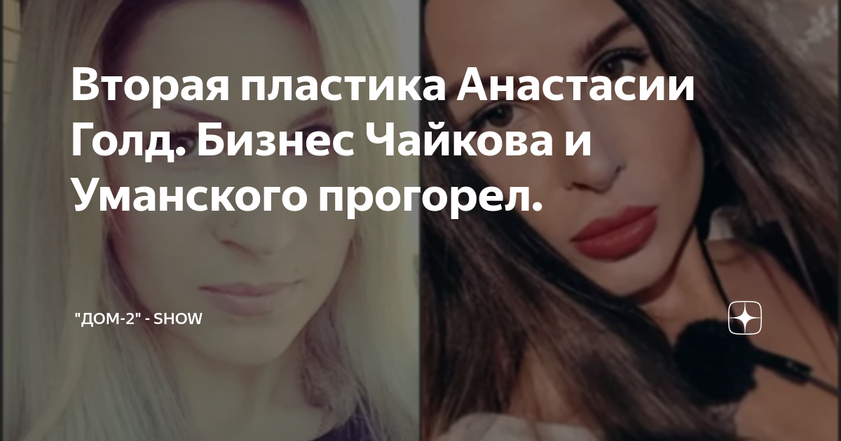 Были простушками, а превратились в жалкие копии друг друга: как выглядели Алёна 
