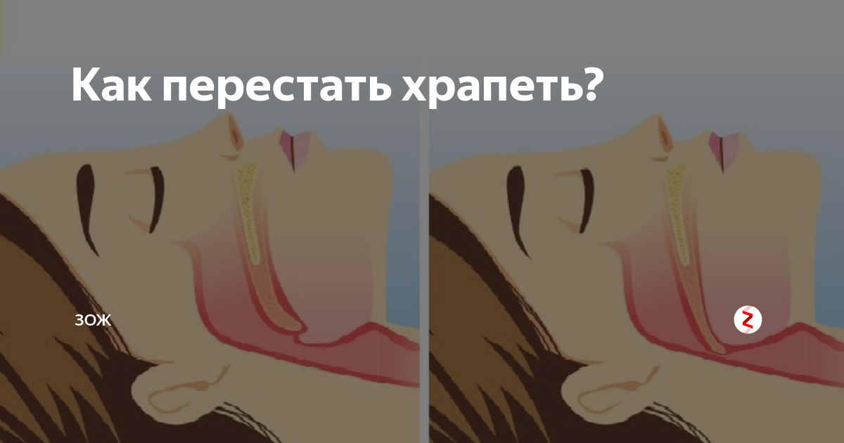 Что нужно сделать чтобы не храпеть ночью. Как перестатььхрапеть. как перестать хри петь. как перестать храпеть. как не храпеть.