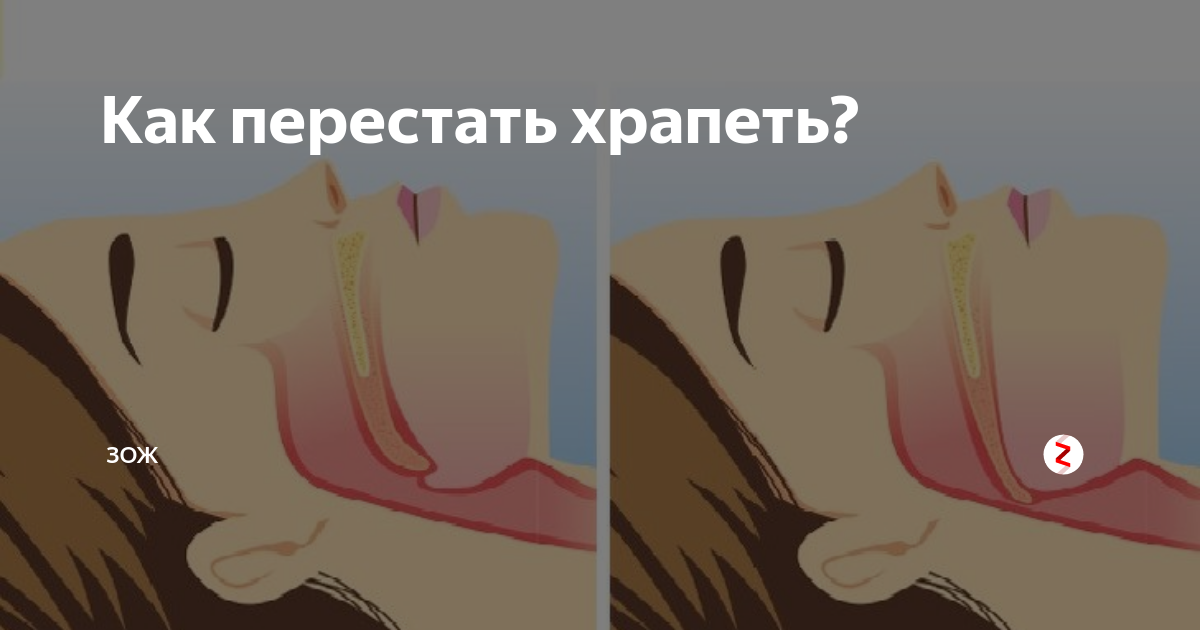 Как перестатььхрапеть. Как перестать Хри петь. Как перестать храпеть. Как не храпеть.